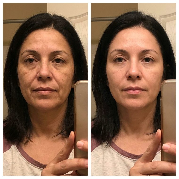 Illustrative before and after comparison